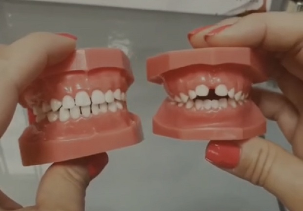 Voici comment la tétine affecte les dents des bébés