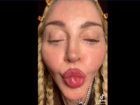 Madonna nouveau visage refait